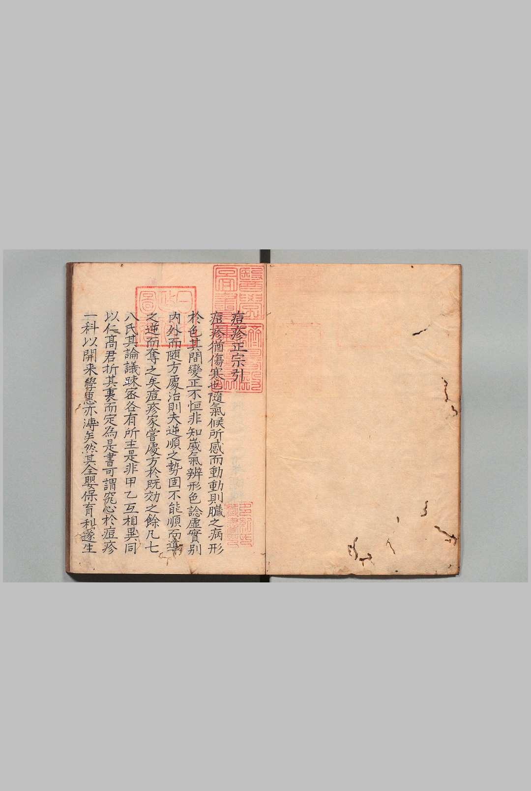 痘疹正宗 ４卷 高武（明）写本 ,江户