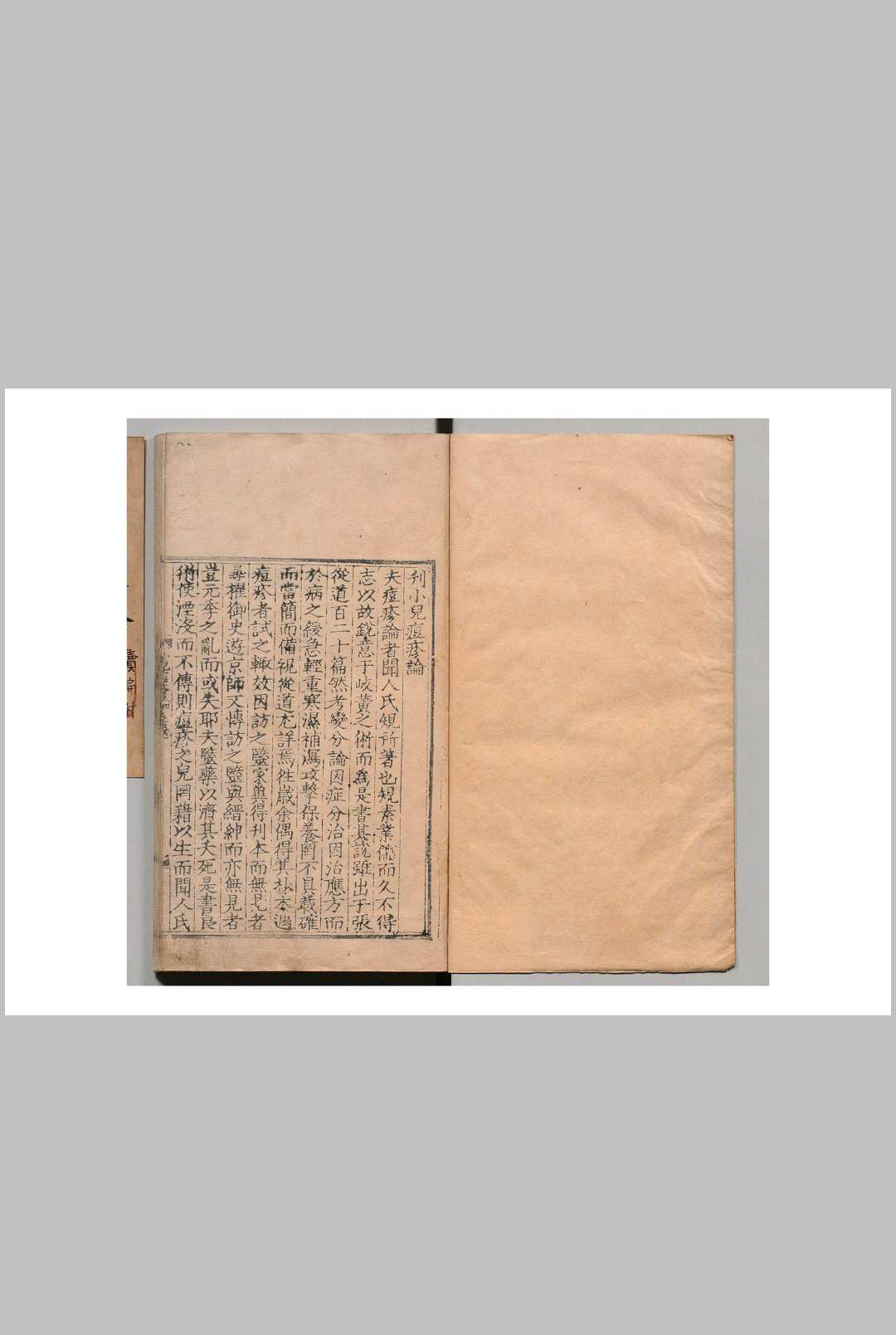 闻人氏痘疹论 闻人规（元）刘尚义（明） 李倬（明） 明嘉靖37年