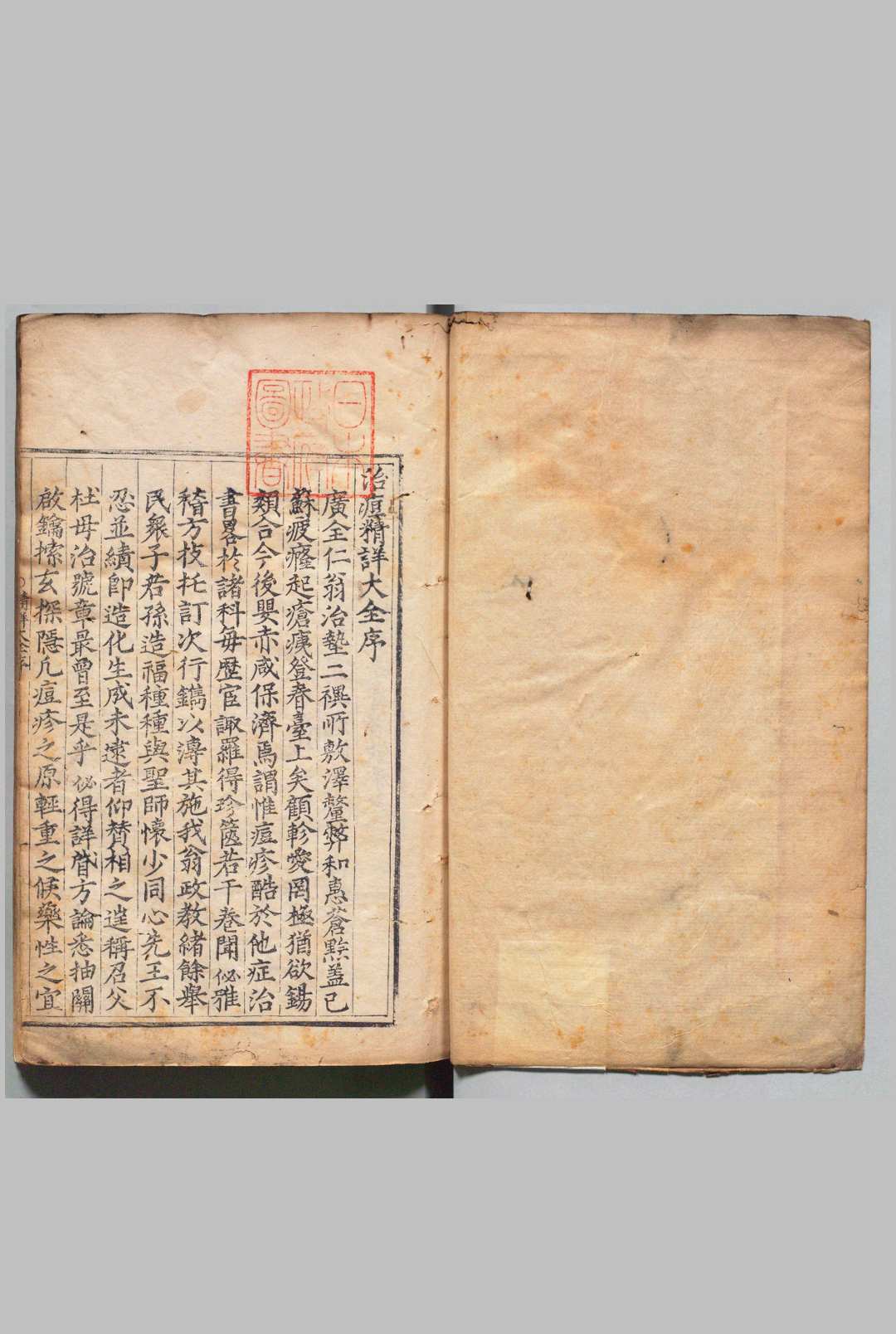 治痘精详大全 16卷（卷７欠） 伍匡世,明万历22年