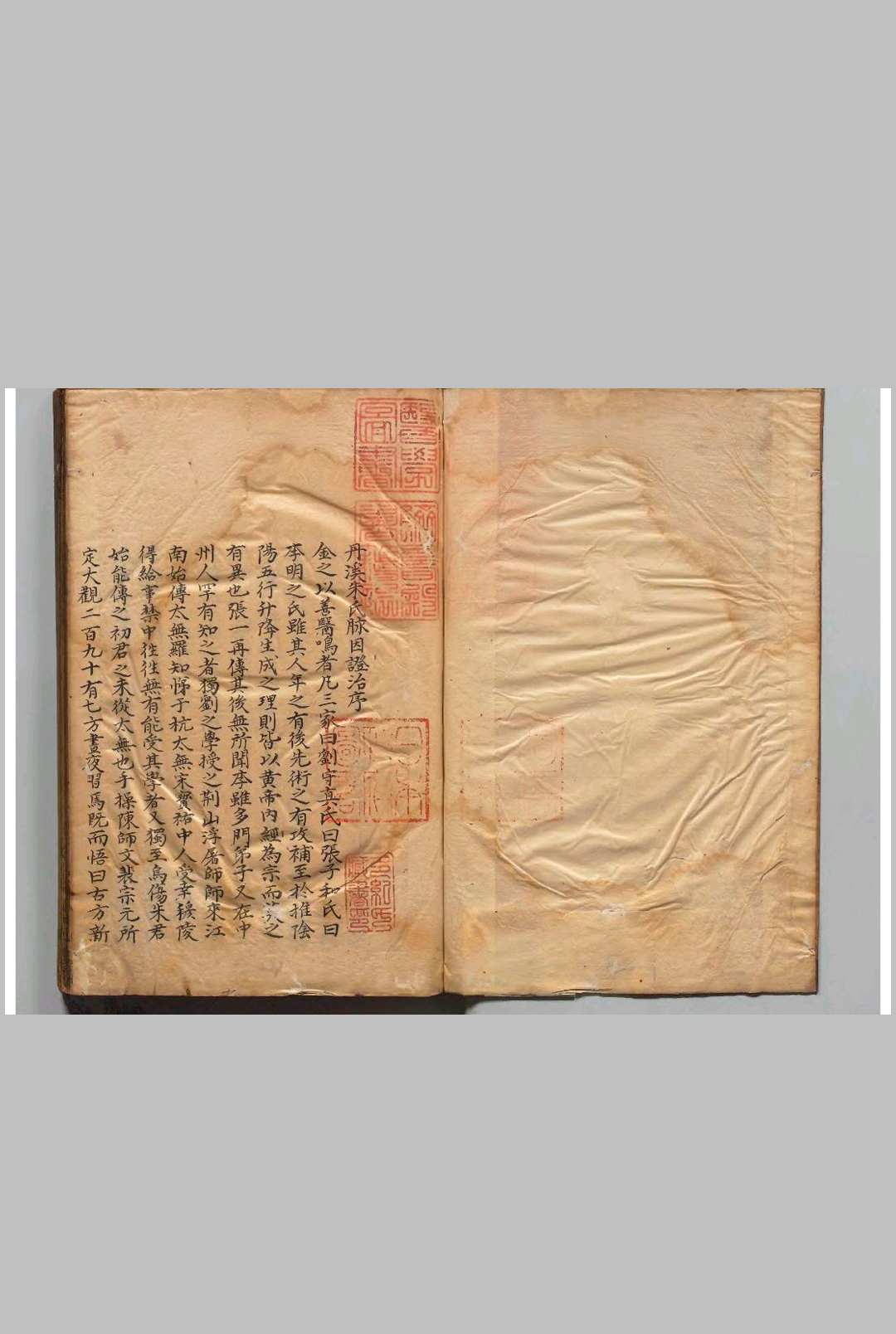 丹溪朱氏脉因证治 朱震亨（元）
