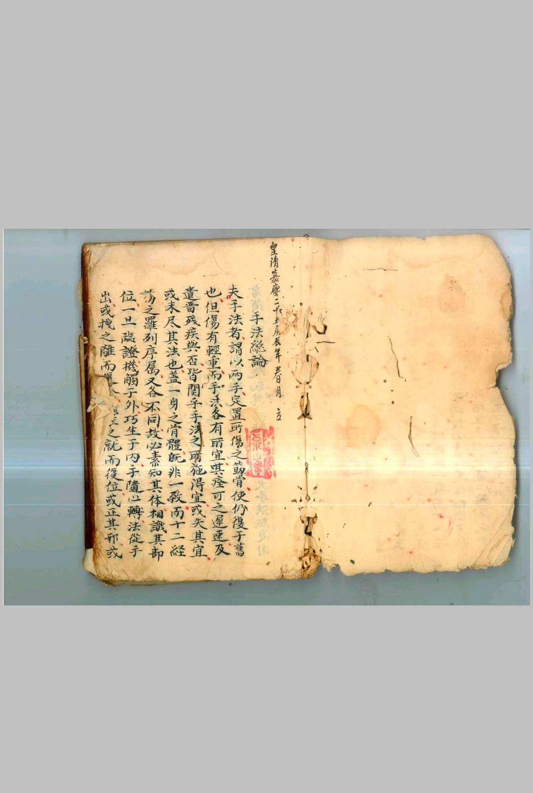 《正骨秘方手法总论》