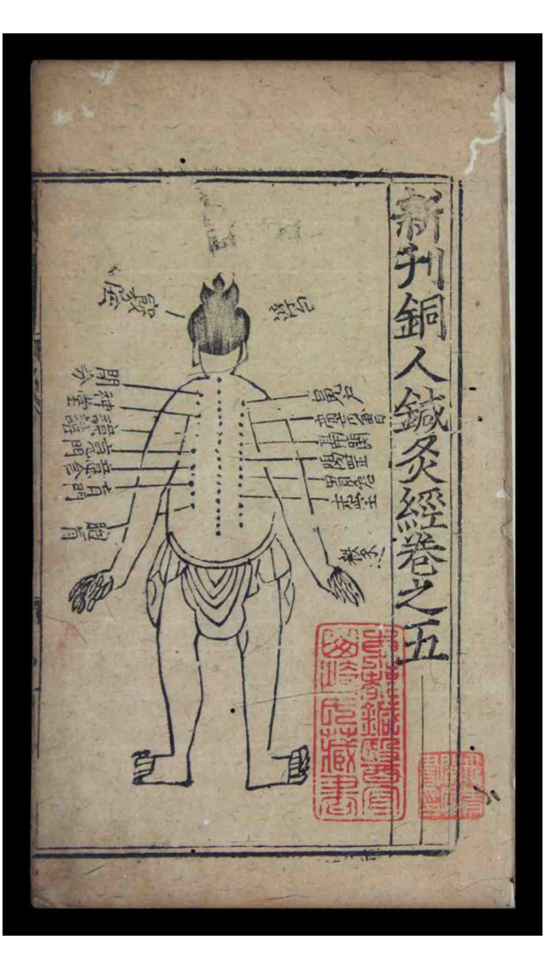 新刊铜人针灸经，七卷