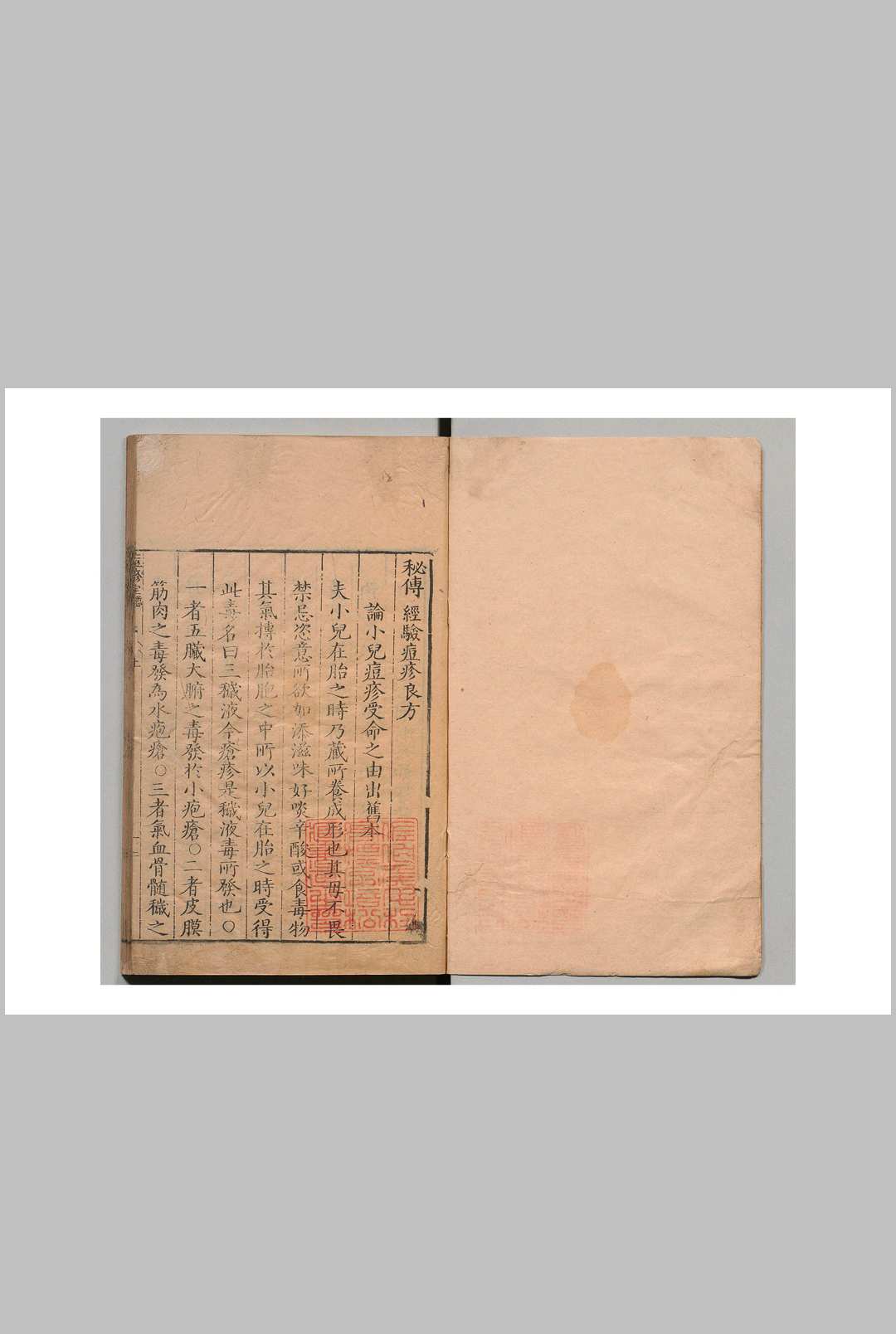 秘传经验痘疹良方 ３卷 明刊本