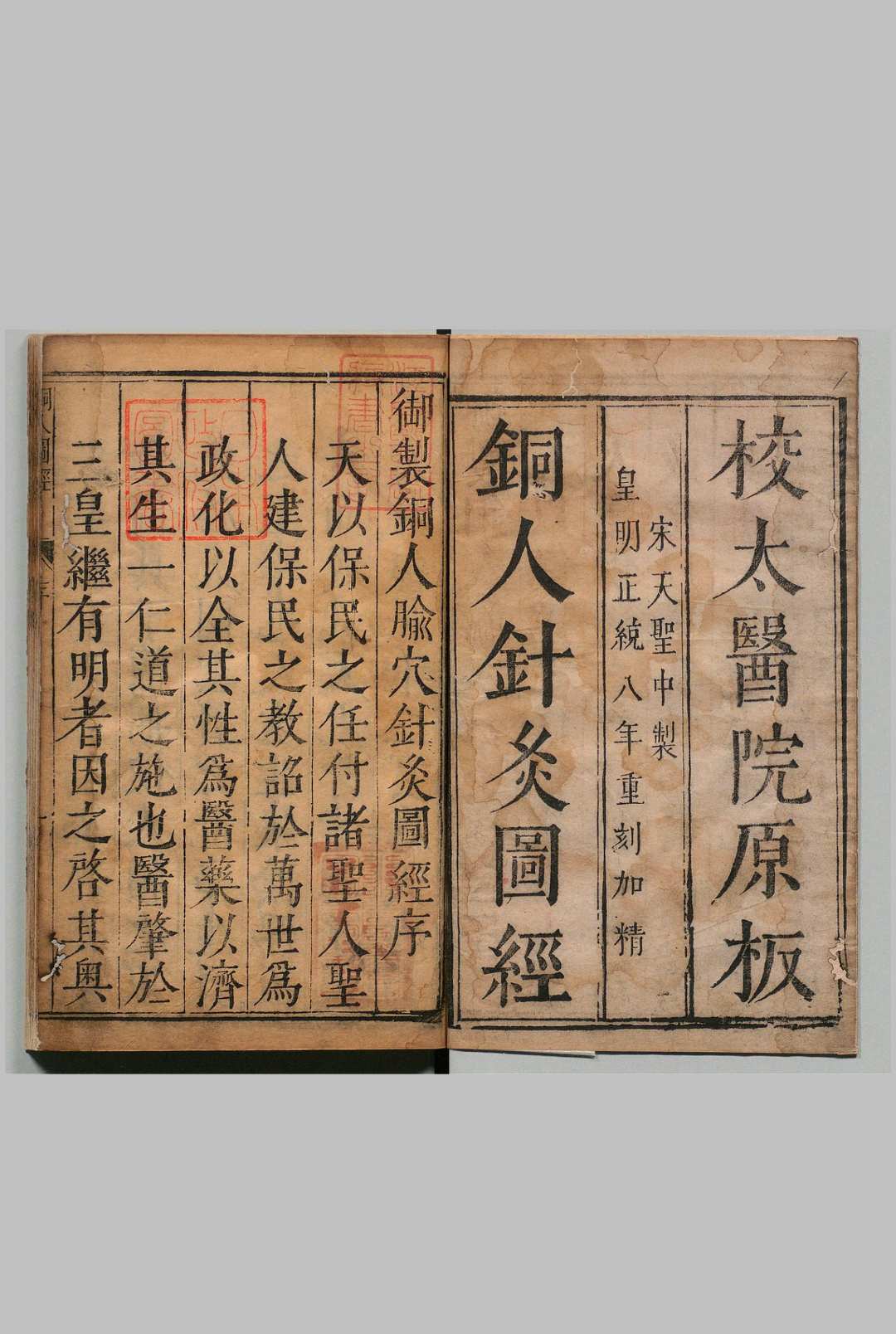 铜人腧穴针灸图经 ３卷 穴腧都数 １卷 王惟一（宋） 明刊本