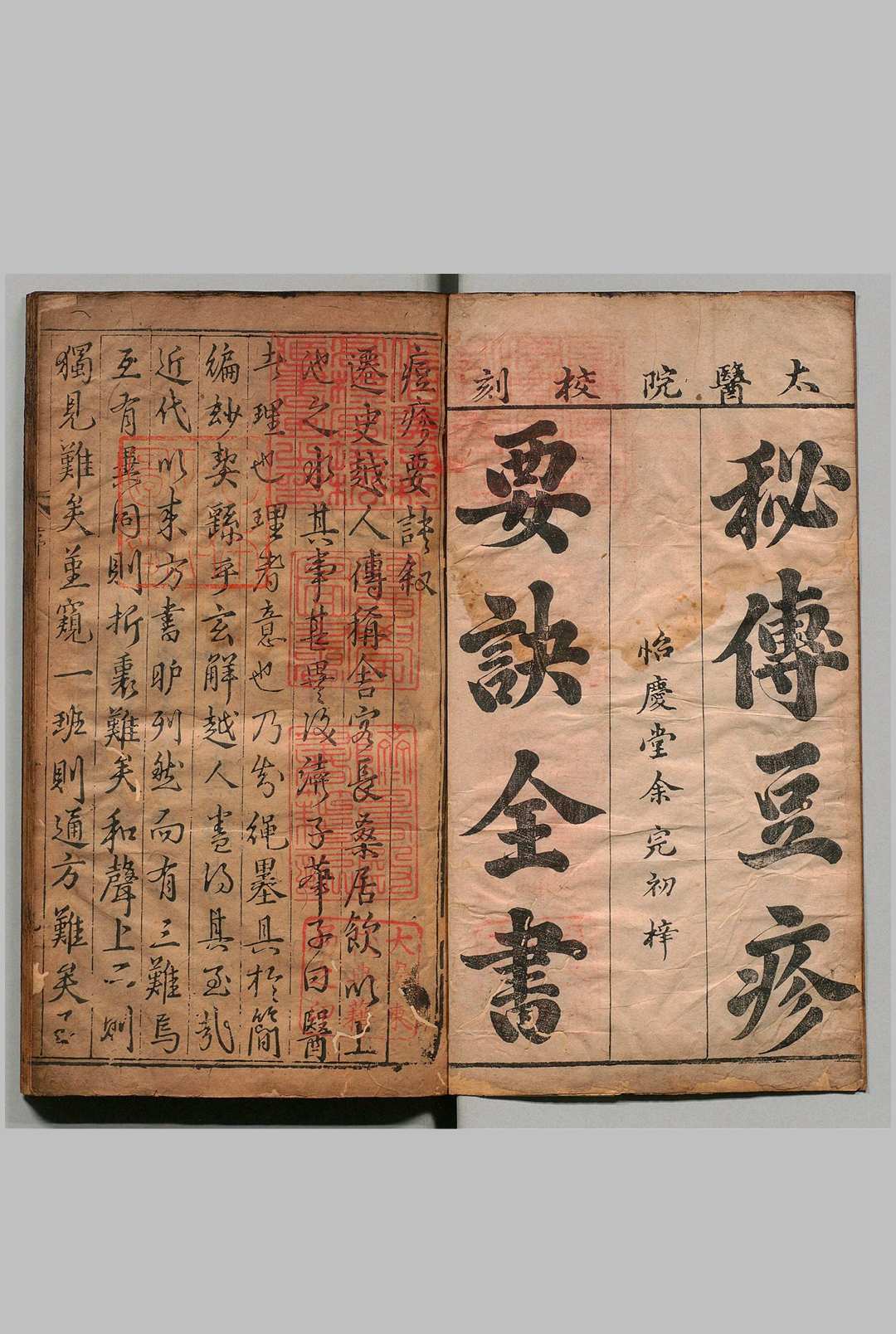 新刊痘疹证治要诀 ５卷 卢铣 明刊本 , 余氏怡庆堂