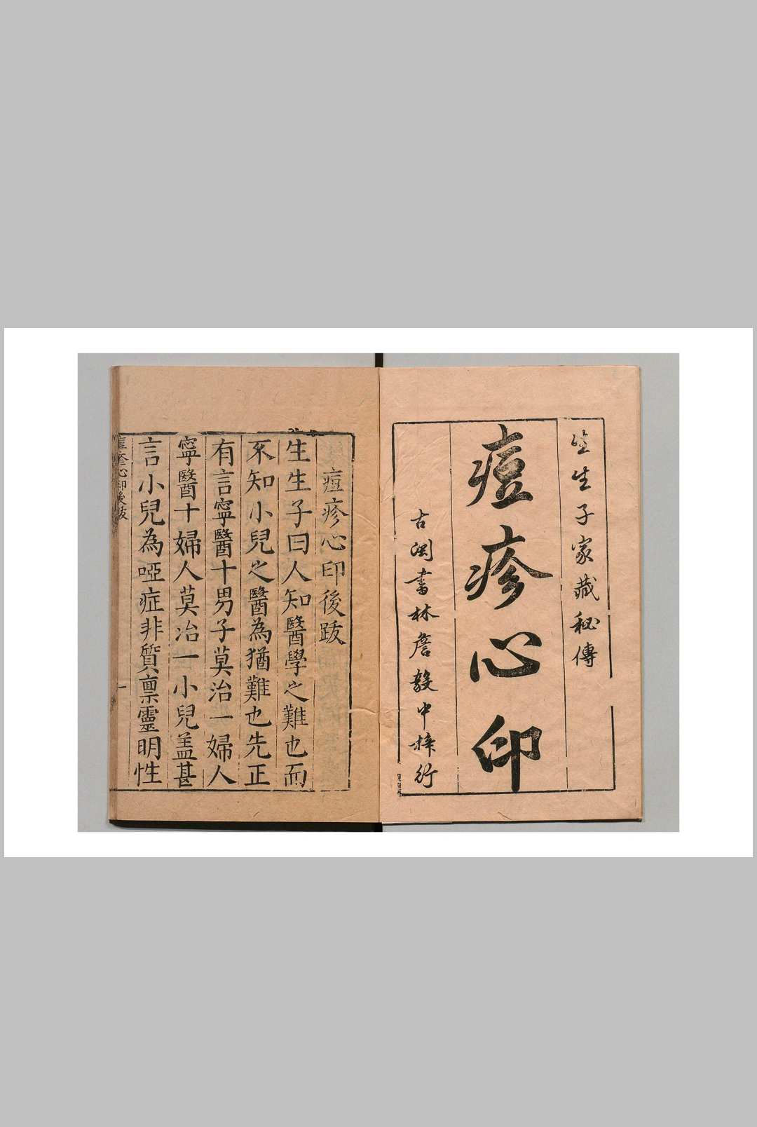 新镌痘疹心印 孙一奎（明）